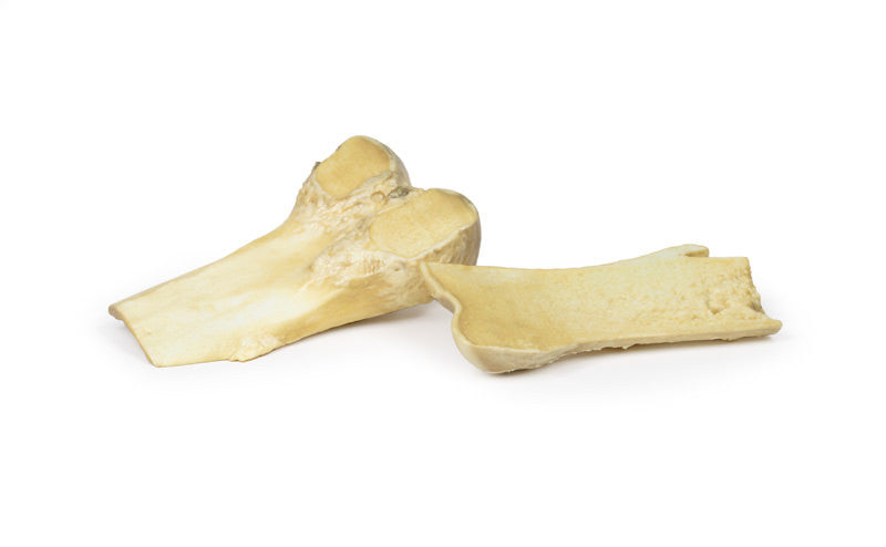 Osteochondroma