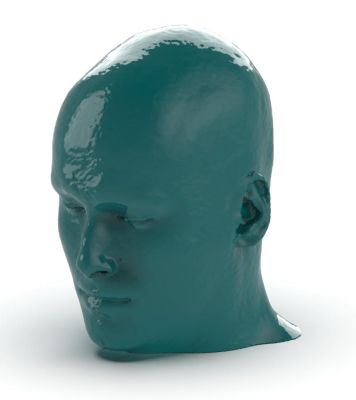 Head / neck CTA phantom AVM