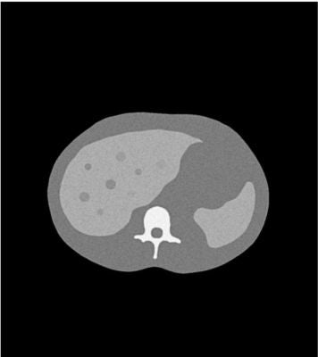 Uniform abdomen phantom LC spheres