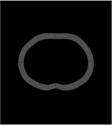 2.5 cm fat ring for abdomen phantom