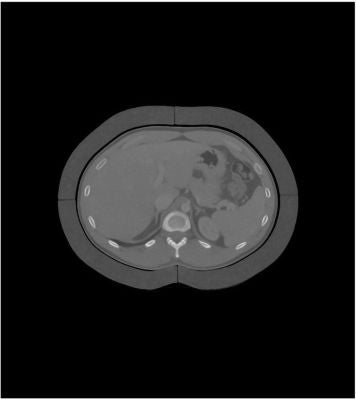 2.5 cm fat ring for abdomen phantom