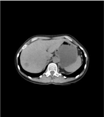 Abdomen / pelvis phantom native