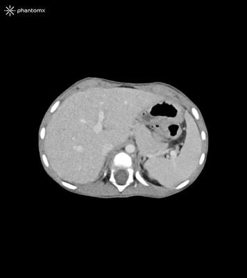 Child Torso Phantom 3-year-old