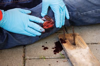 Wound moulage "Cut"