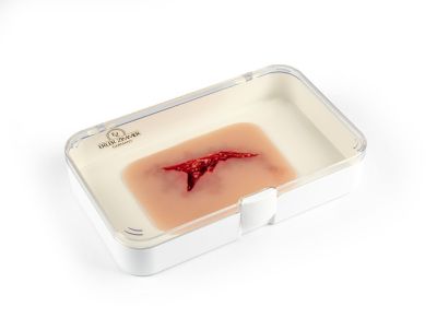 Wound moulage "laceration"