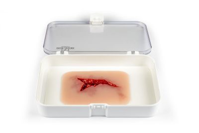 Wound moulage "laceration"