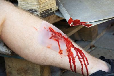 Wound moulage "laceration"