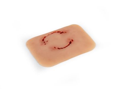 Wound moulage "human bite"
