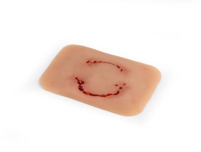 Wound moulage "human bite"