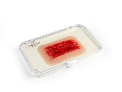 Wound moulage "abrasion"