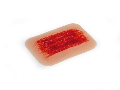 Wound moulage "abrasion"