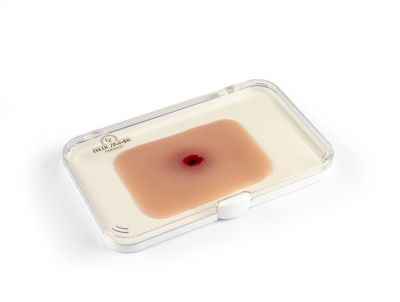 Wound moulage bullet entrance hole