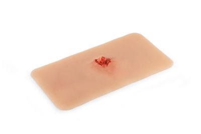 Wound moulage open fracture, arm bone with bleeding function