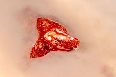 Wound moulage open fracture, leg with bleeding function