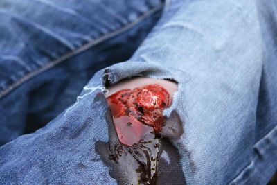 Wound moulage open fracture, leg with bleeding function