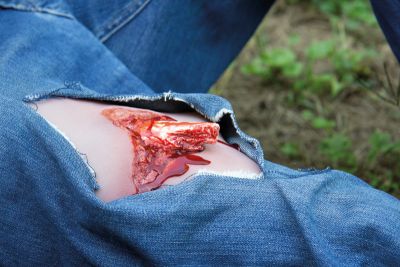Wound moulage open fracture, leg with bleeding function