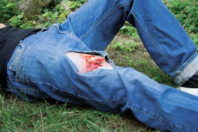 Wound moulage open fracture, leg with bleeding function
