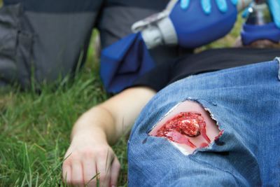 Wound moulage open fracture, leg with bleeding function