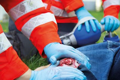 Wound moulage open fracture, leg with bleeding function