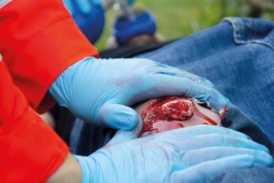 Wound moulage open fracture, leg with bleeding function
