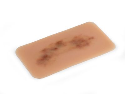 Wound moulage hematoma fresh