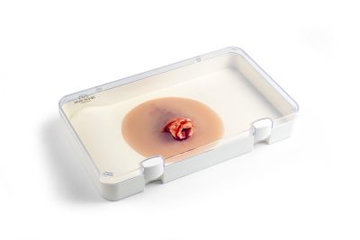 Wound presentation open fracture ankle joint
