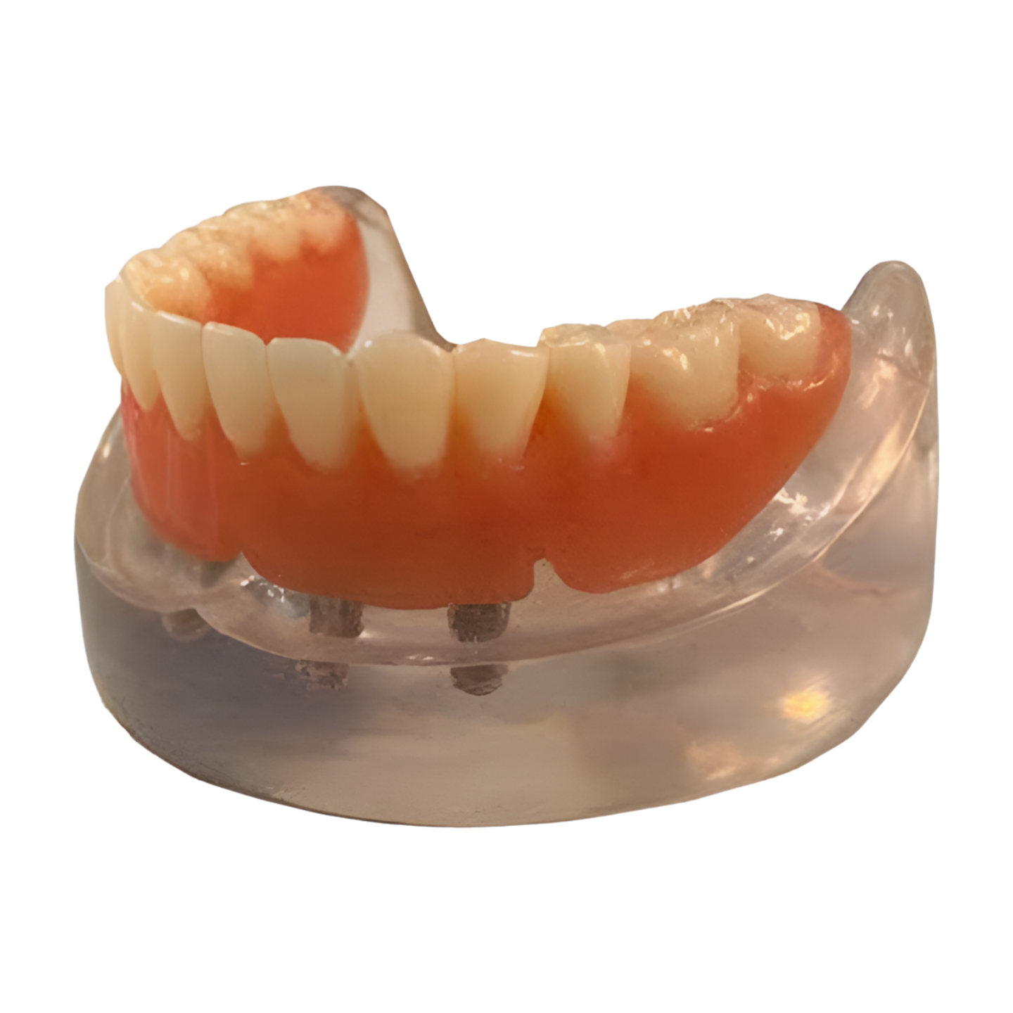 OCBI-4C – Mandible Hader Bar