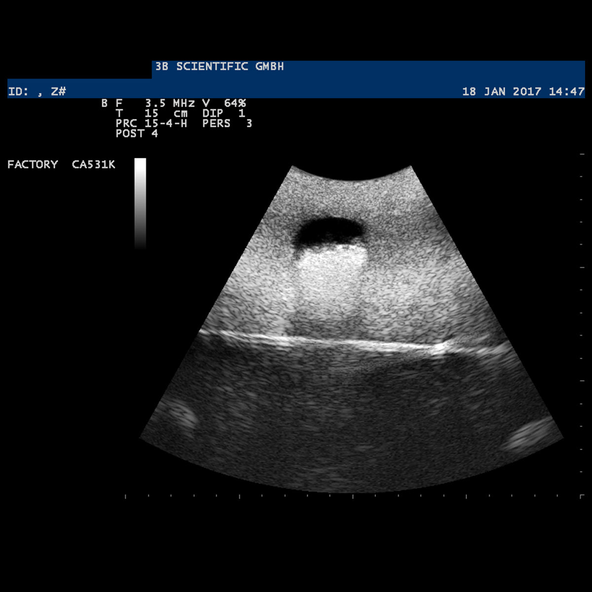 SONOtrain Ultrasound Vein Model, Light Skin