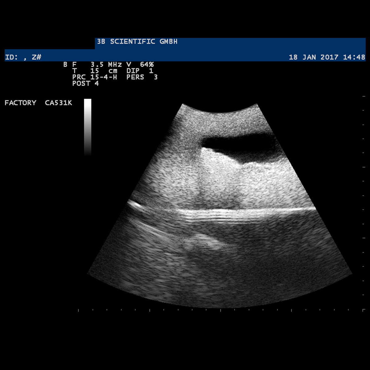 SONOtrain Ultrasound Vein Model, Light Skin