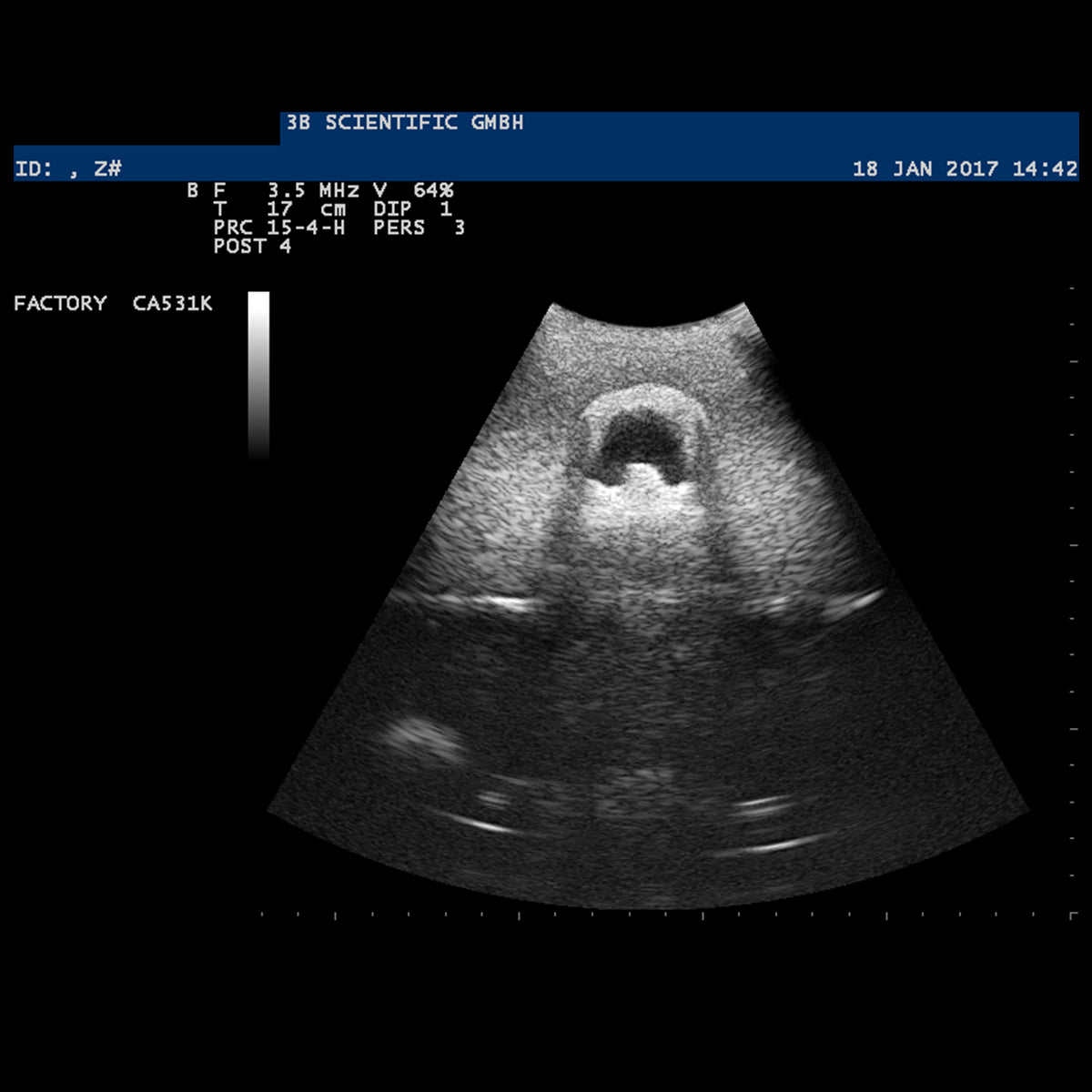 SONOtrain Ultrasound Vein Model, Light Skin
