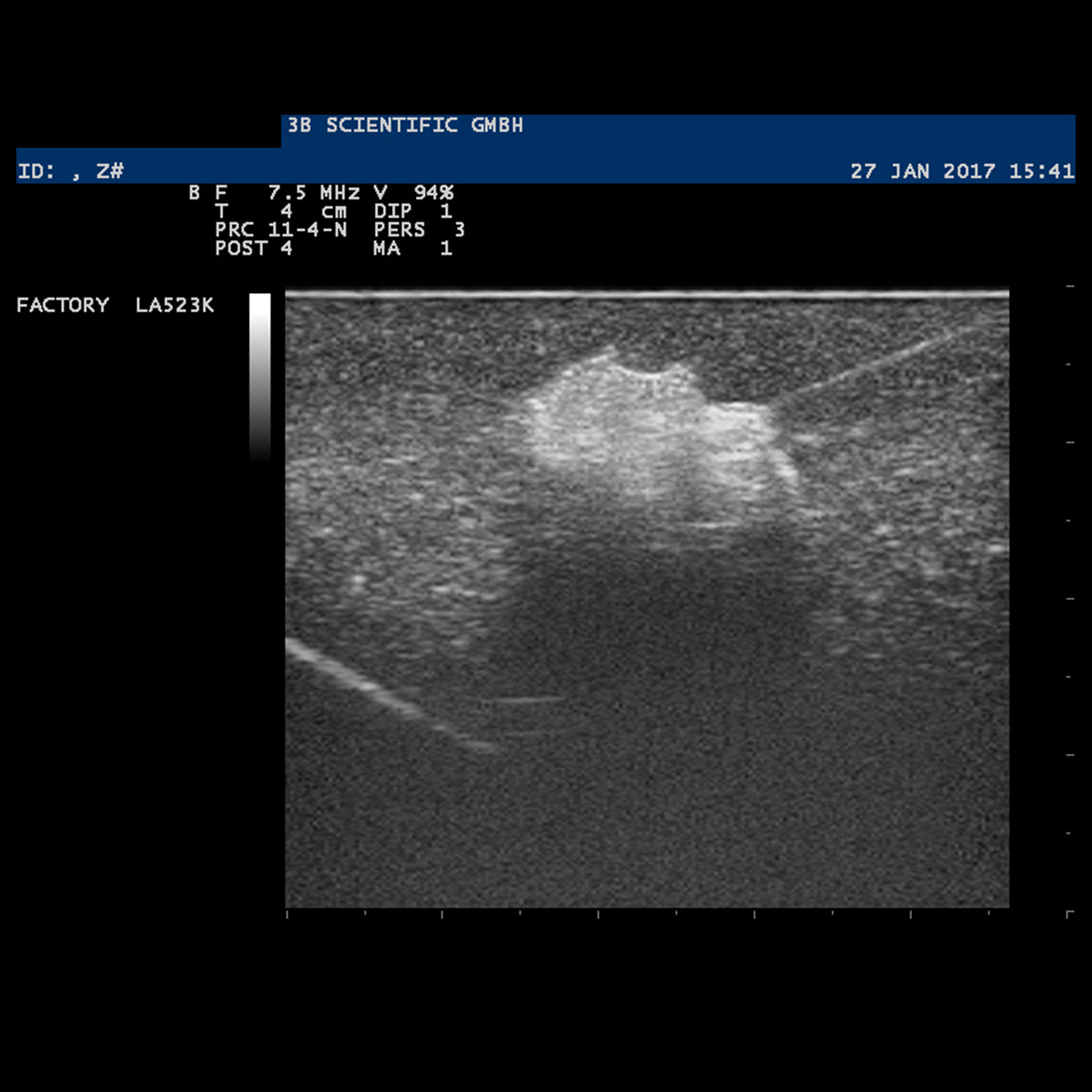 SONOtrain Breast model with tumours