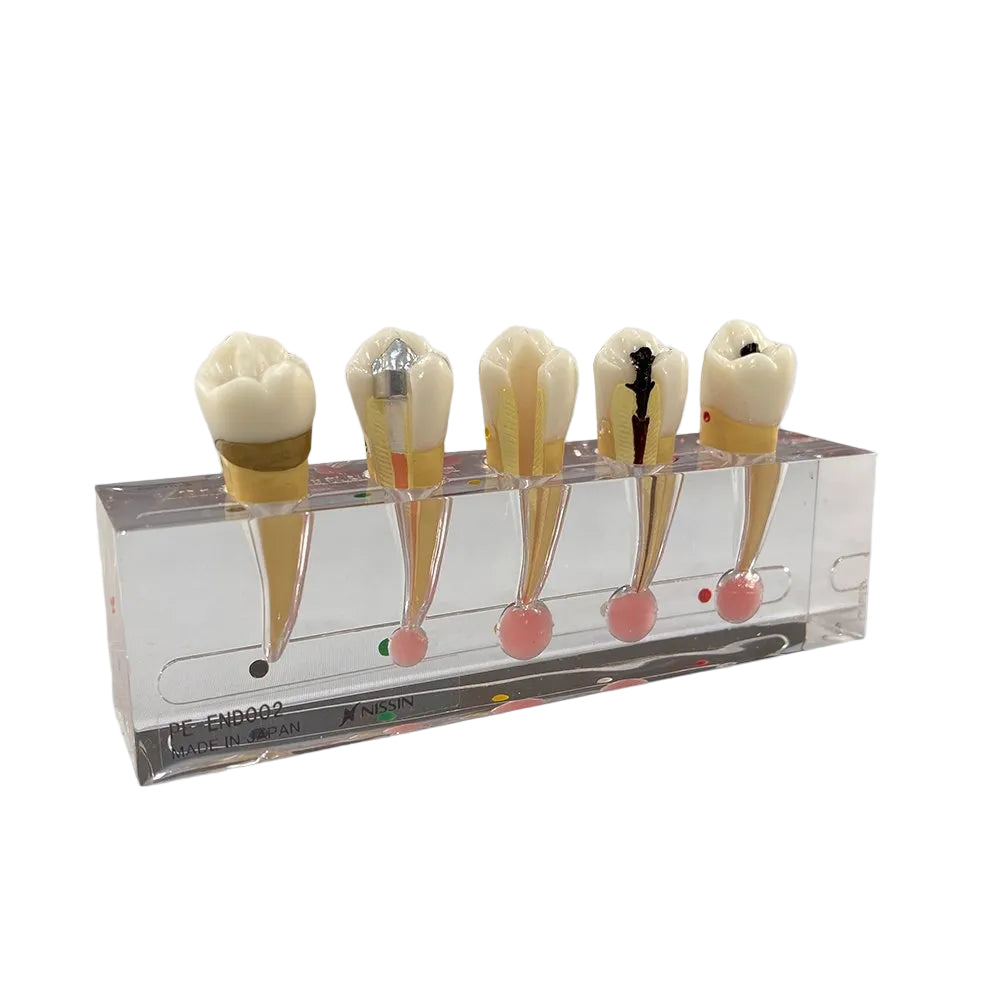 P23-END.2 endodontic sequence model, 5-tooth progression overview