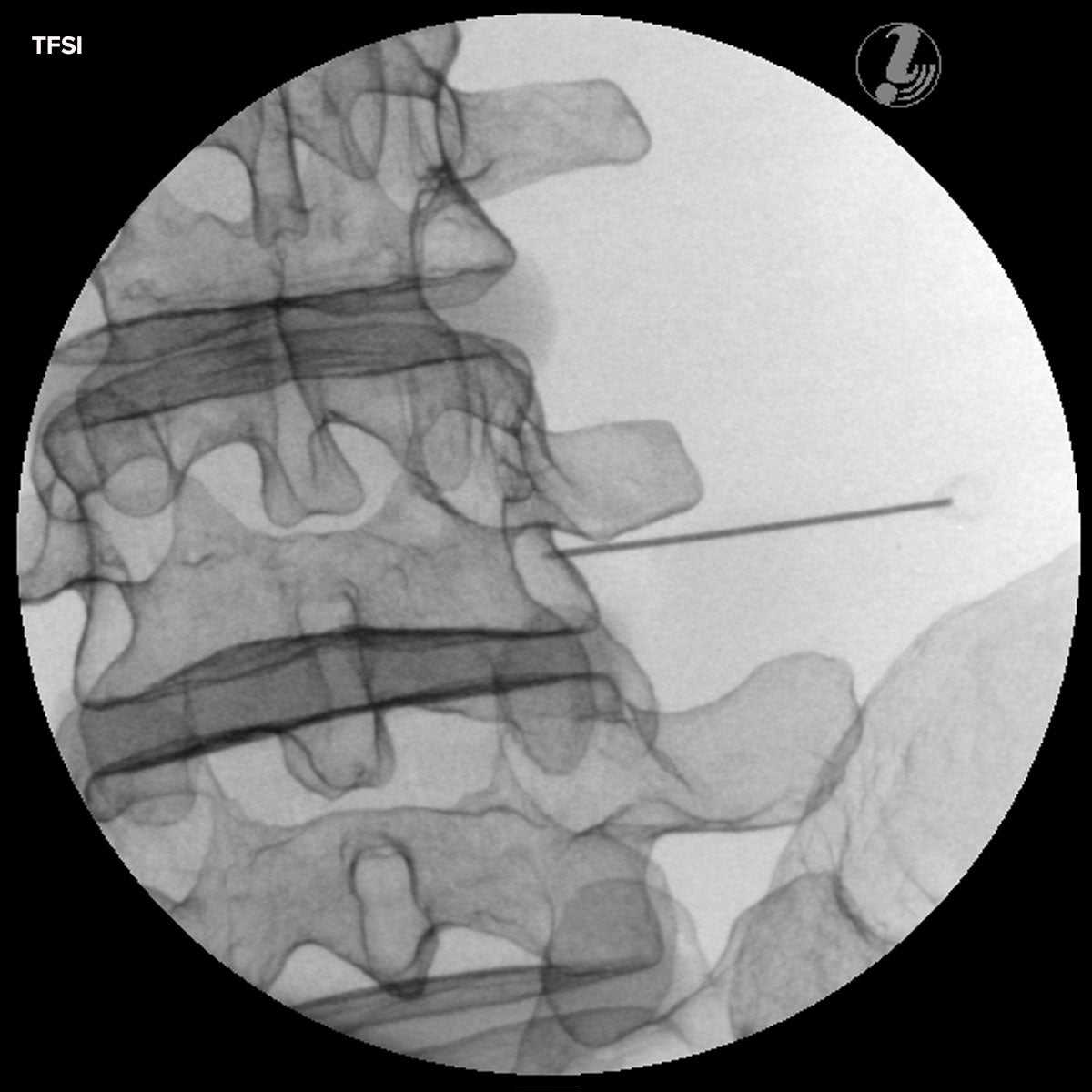 Image Guided Lumbar Spinal Injection Trainer P65