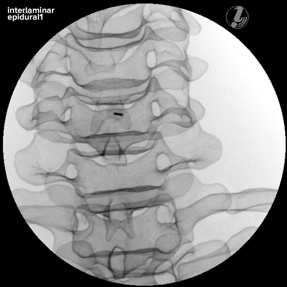 Image Guided Cervical Spine Injection Trainer P67