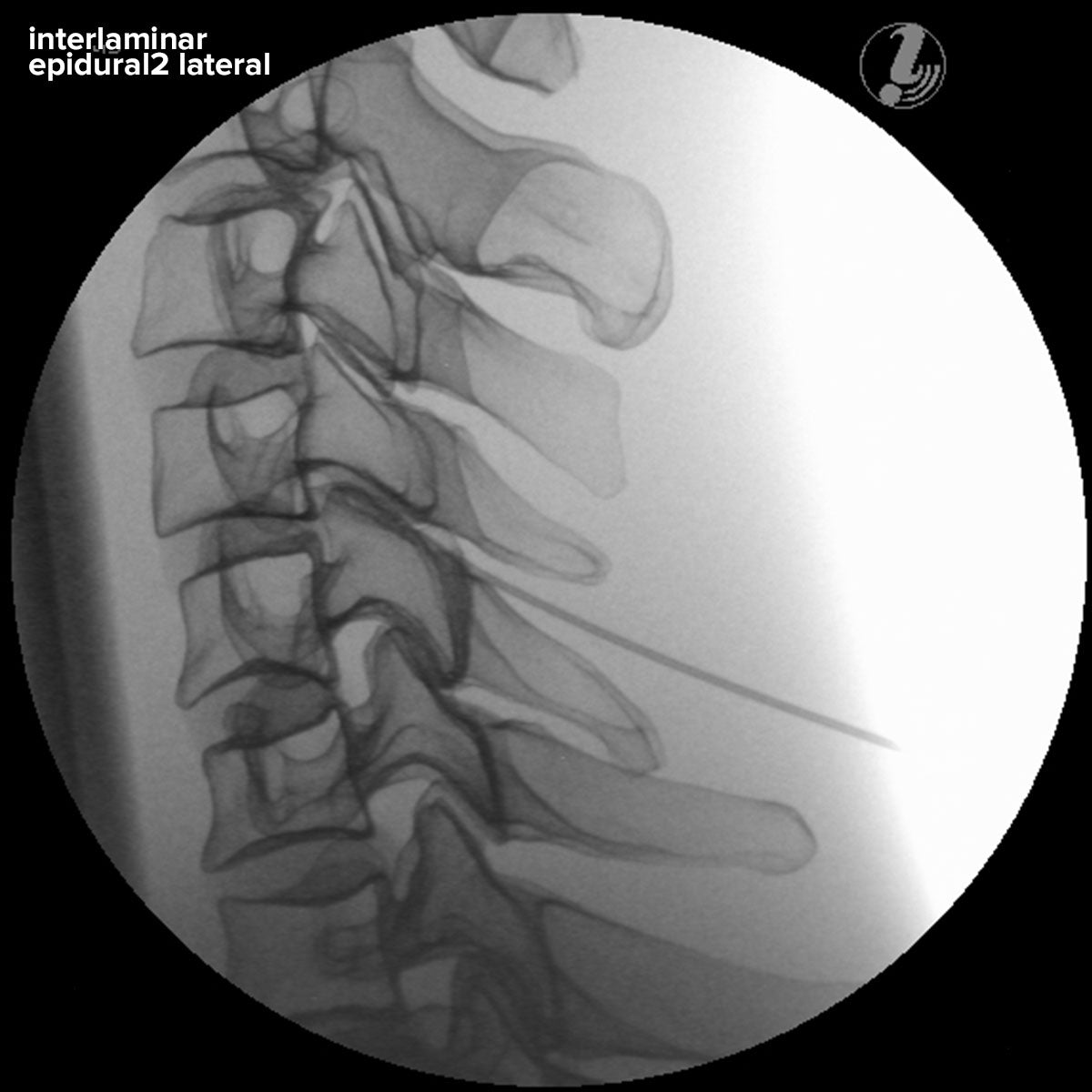 Image Guided Cervical Spine Injection Trainer P67