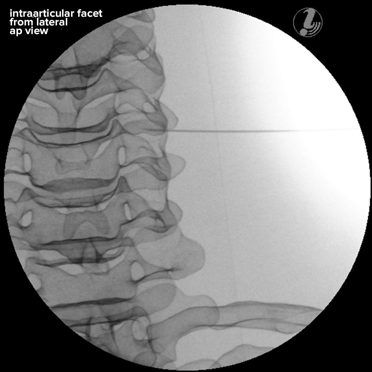 Image Guided Cervical Spine Injection Trainer P67