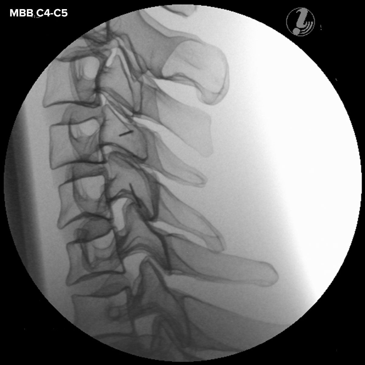 Image Guided Cervical Spine Injection Trainer P67