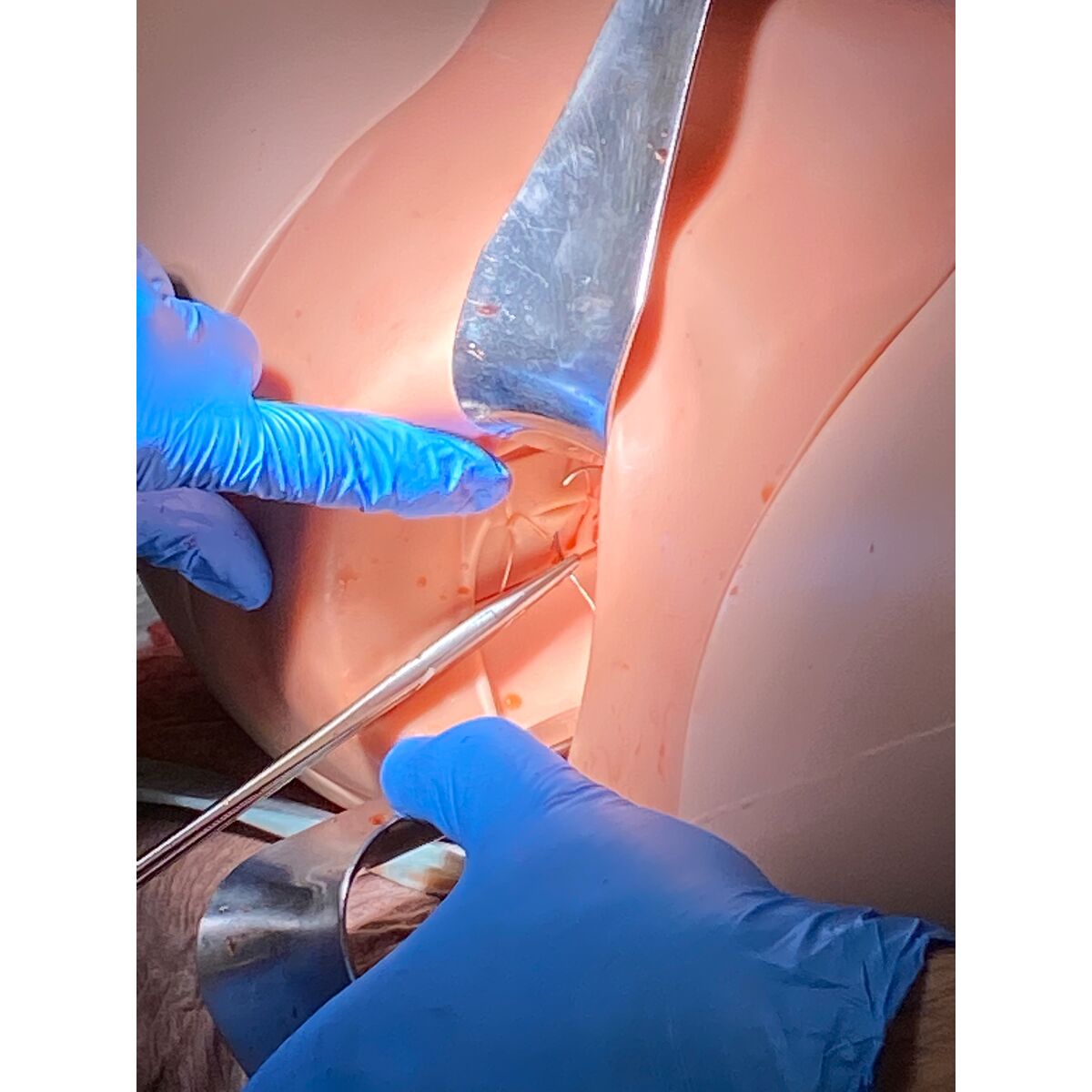 Postpartum Hemorrhage Simulator – PPH Trainer P97 PRO, Light Skin