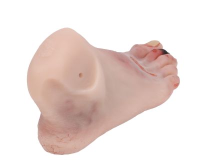 Wound foot with diabetic foot syndrome, manikin version - Erler-Zimmer PW006P, view 4