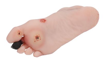 Wound foot with diabetic foot syndrome, manikin version - Erler-Zimmer PW006P, view 5