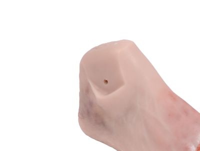 Wound foot with diabetic foot syndrome, severe stage, manikin version - Erler-Zimmer PW007P, view 3