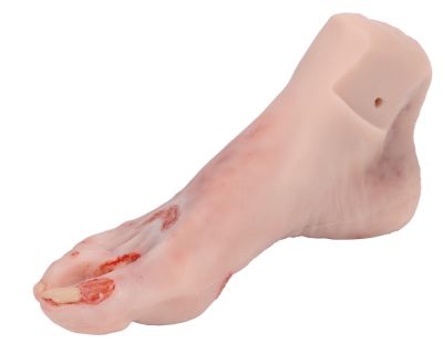 Wound foot with diabetic foot syndrome, severe stage, manikin version - Erler-Zimmer PW007P, view 4