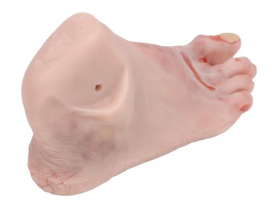 Wound foot with diabetic foot syndrome, severe stage, manikin version - Erler-Zimmer PW007P, view 2