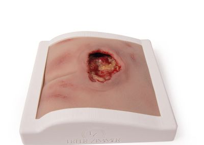 Wound moulage sacral decubitus, cleaned including stand - Erler-Zimmer PW008BTM, view 5