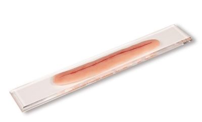 Surgical wound, without suture, 22cm - Erler-Zimmer PW009A