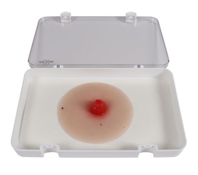 Ileostomy wound moulage, self-adhesive - Erler-Zimmer PW020P