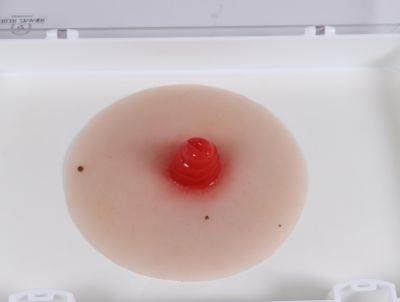 Ileostomy wound moulage, self-adhesive - Erler-Zimmer PW020P, view 2