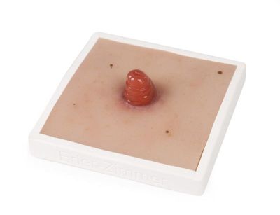Wound Moulage Ileostomy, incl. stand - Erler-Zimmer PW020, view 2