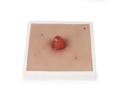 Wound Moulage Ileostomy, incl. stand - Erler-Zimmer PW020, view 3