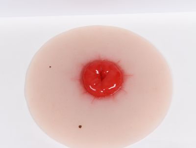 Wound moulage colostomy, self-adhesive - Erler-Zimmer PW021P, view 2